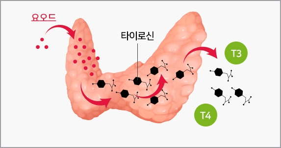 갑상선 저하증에 대해 설명한 이미지